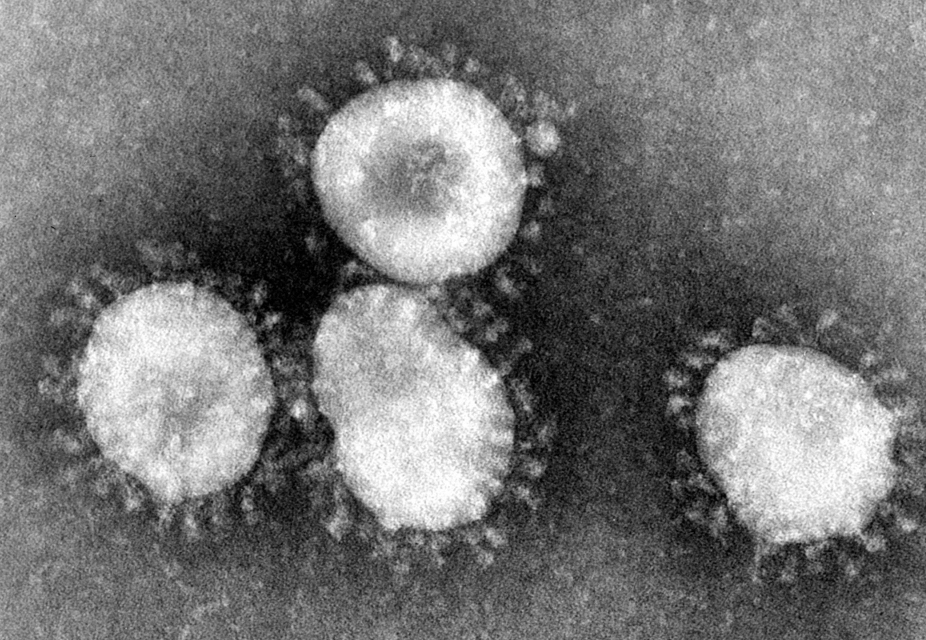 Coronavirus, in Spagna anziani lasciati morire negli ospizi 1